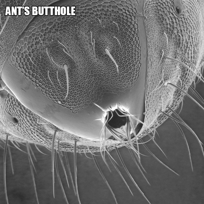     Reddit El culo de una hormiga bajo un microscopio electrónico.