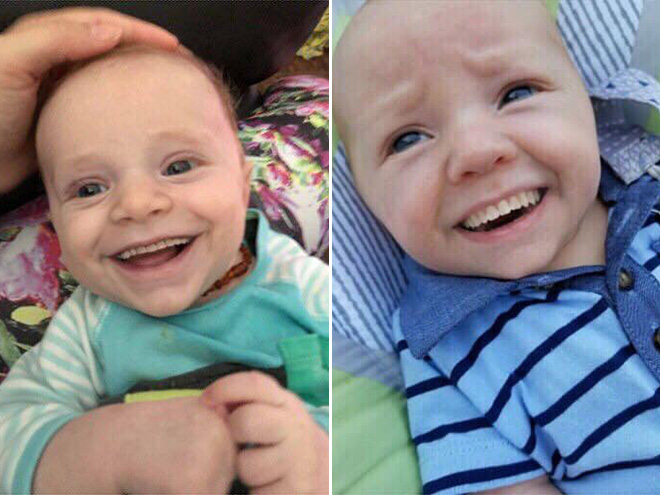 Los bebés con dientes adultos se ven realmente aterradores.