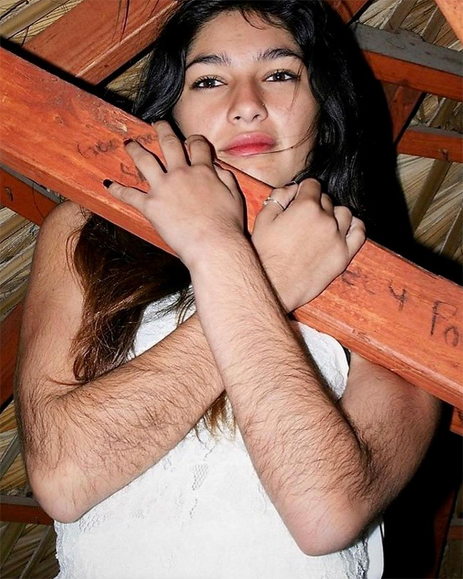 Mujer con brazos extremadamente peludos.