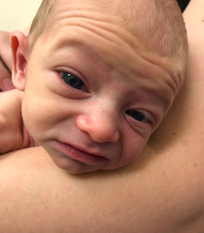 Los bebés feos son una dura realidad.