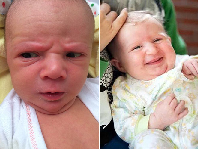 Los bebés feos son una dura realidad.